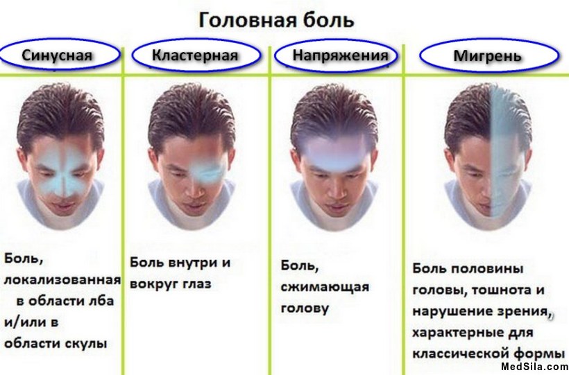 виды головной боли